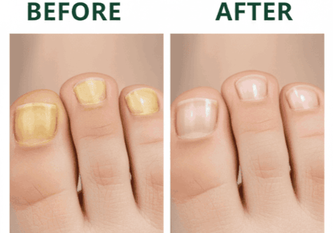 Nail Refresh benefits